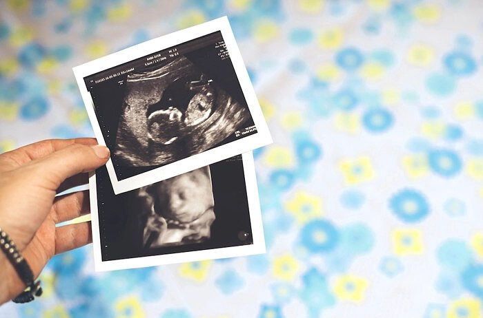 Верховный суд Джорджии восстановил «Закон о сердцебиении», запрещающий аборты после 6-й недели беременности