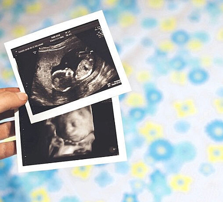 Верховный суд Джорджии восстановил «Закон о сердцебиении», запрещающий аборты после 6-й недели беременности