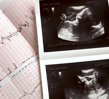 Блокировка судьей штата Джорджия закона о 6-недельных абортах - "ужасный шаг назад", говорят епископы